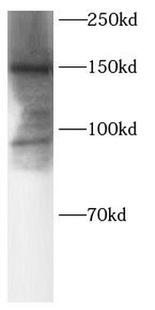 SOS2 Rabbit Polyclonal Antibody