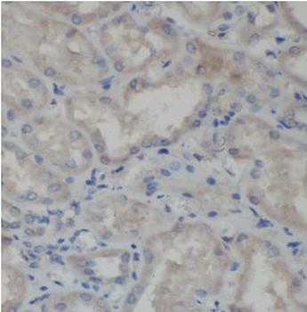 SOS2 Rabbit Polyclonal Antibody