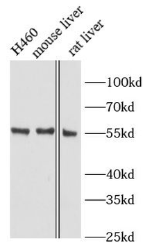 SOAT1 Rabbit Polyclonal Antibody