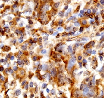 WFDC12 Rabbit Polyclonal Antibody