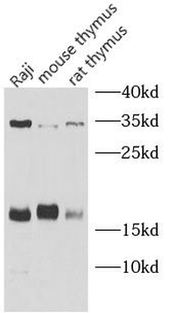 IL22 Rabbit Polyclonal Antibody