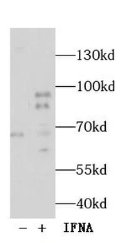 Phospho STAT1 (Tyr701) Rabbit Polyclonal Antibody