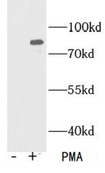 Phospho pan PKC (T410) Rabbit Polyclonal Antibody