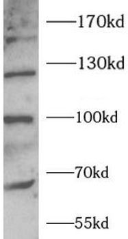 LDLR Rabbit Polyclonal Antibody