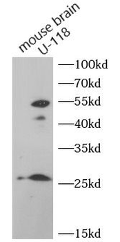 FGF3 Rabbit Polyclonal Antibody