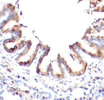 PXDN Rabbit Polyclonal Antibody