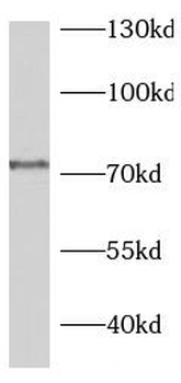 PWWP3A Rabbit Polyclonal Antibody