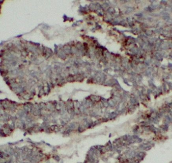 RPL36 Rabbit Polyclonal Antibody