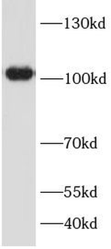 CIP2A Rabbit Polyclonal Antibody