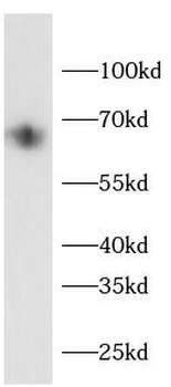IRAK3 Rabbit Polyclonal Antibody
