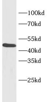 VEGFC Mouse Monoclonal Antibody