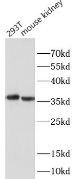 AKR1B10 Rabbit Polyclonal Antibody