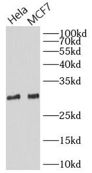 PGAM5 Rabbit Polyclonal Antibody
