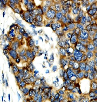 PGAM5 Rabbit Polyclonal Antibody