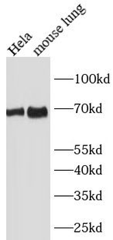 SLC1A5 Rabbit Polyclonal Antibody