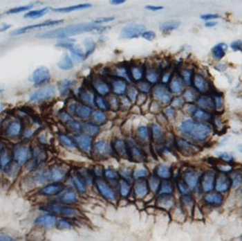 SLC1A5 Rabbit Polyclonal Antibody