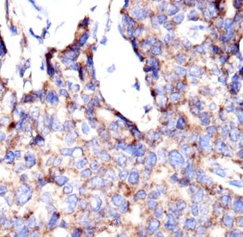 TOMM20 Mouse Monoclonal Antibody