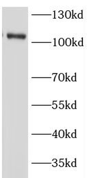 OSBPL3 Rabbit Polyclonal Antibody