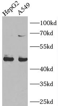 PPARG Mouse Monoclonal Antibody