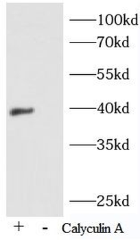 Phospho-IKBA (Ser32/36) Rabbit Polyclonal Antibody