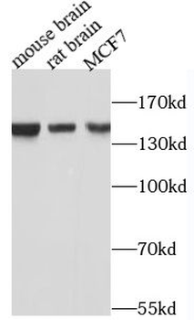GLI1 Rabbit Polyclonal Antibody