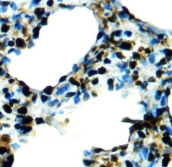GLI1 Rabbit Polyclonal Antibody