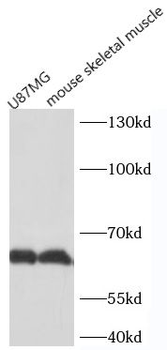 HAS1 Rabbit Polyclonal Antibody