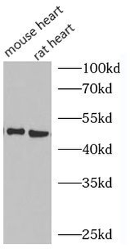 GLUT4 Mouse Monoclonal Antibody