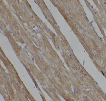 GLUT4 Mouse Monoclonal Antibody