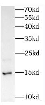 FABP6 Rabbit Polyclonal Antibody