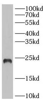 IL6 Mouse Monoclonal Antibody