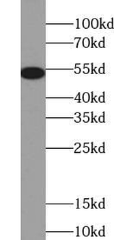 6*His His Tag Rabbit Polyclonal Antibody