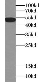 Acetylated tubulin Mouse Monoclonal Antibody