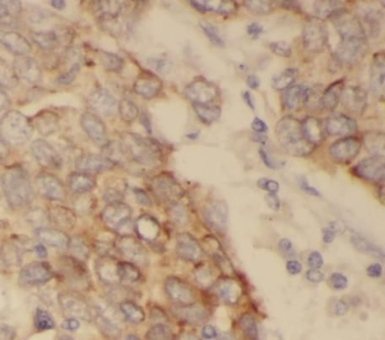 Acetylated tubulin Mouse Monoclonal Antibody