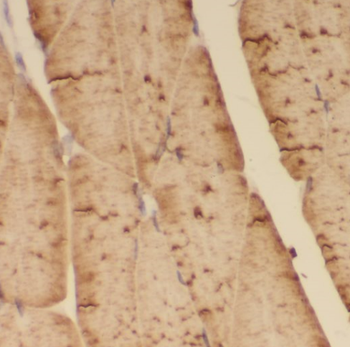 ACTA1 Specific Rabbit Polyclonal Antibody