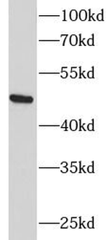 PLIN2 Rabbit Polyclonal Antibody