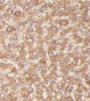 PLIN2 Rabbit Polyclonal Antibody