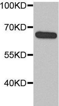 MTDH Specific Rabbit Polyclonal Antibody