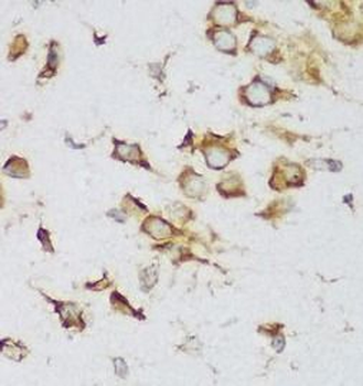 MTDH Specific Rabbit Polyclonal Antibody
