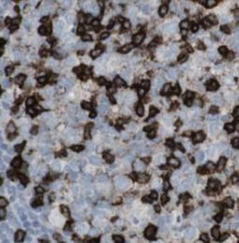 ALK Mouse Monoclonal Antibody