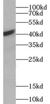 ACTC1 specific Mouse Monoclonal Antibody