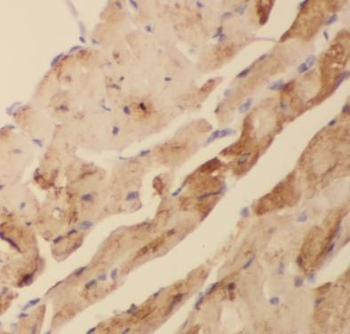 ACTC1 specific Mouse Monoclonal Antibody