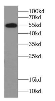 SERPINF2 Rabbit Polyclonal Antibody