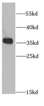 PRKAB2 Rabbit Polyclonal Antibody