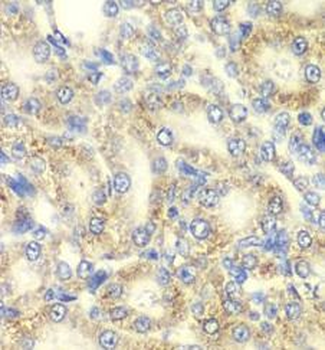PRKAB2 Rabbit Polyclonal Antibody