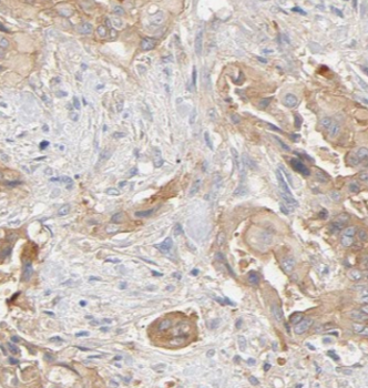 AMY2B Rabbit Polyclonal Antibody