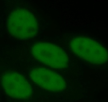 ANP32B Mouse Monoclonal Antibody