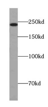 ANAPC1 Rabbit Polyclonal Antibody