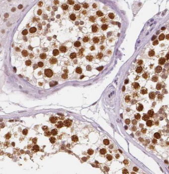 ANAPC1 Rabbit Polyclonal Antibody
