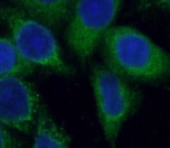 ARF6 Specific Rabbit Polyclonal Antibody